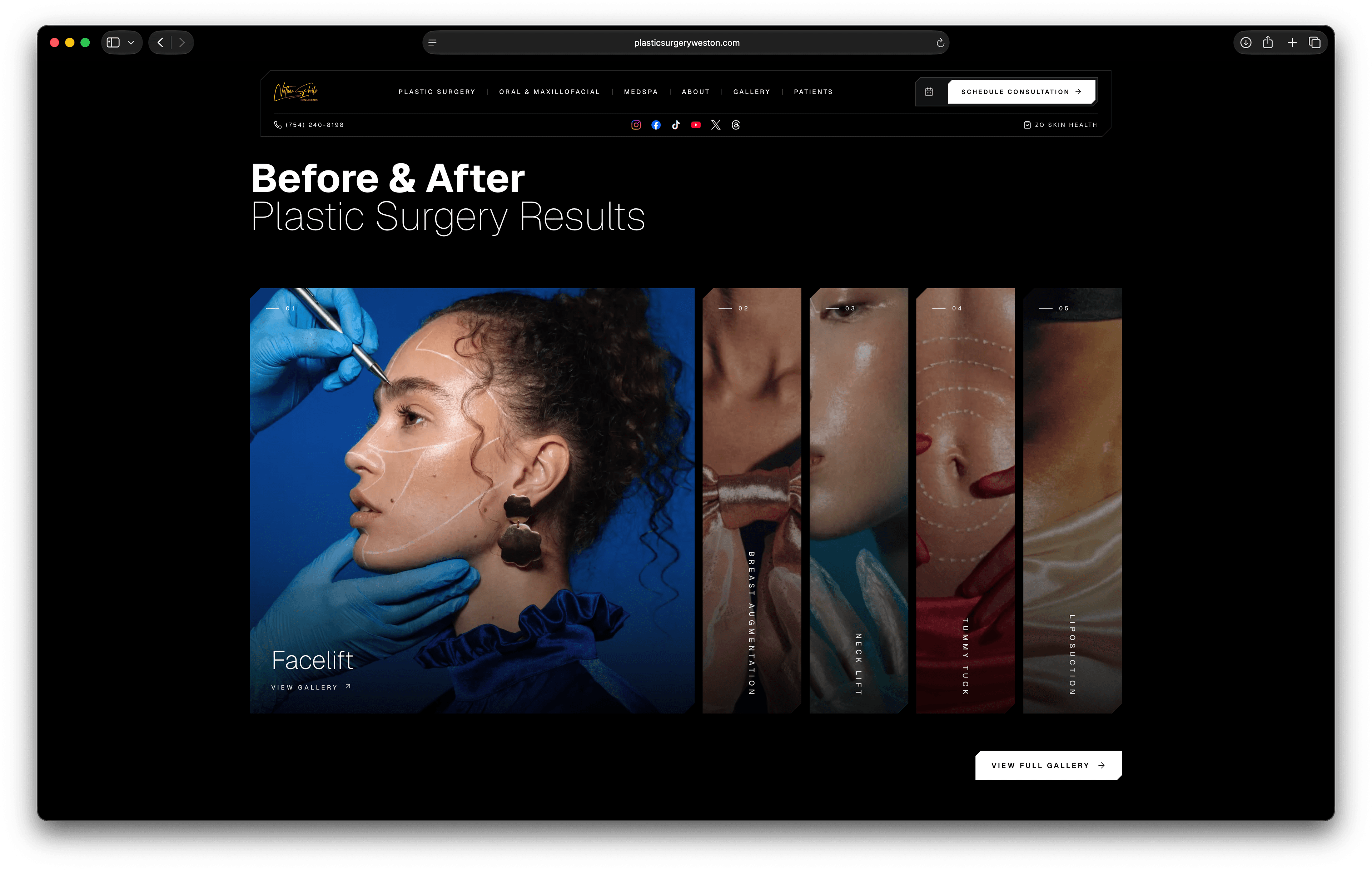 Expandable gallery categories with fluid animation on the Weston plastic surgery website redesign